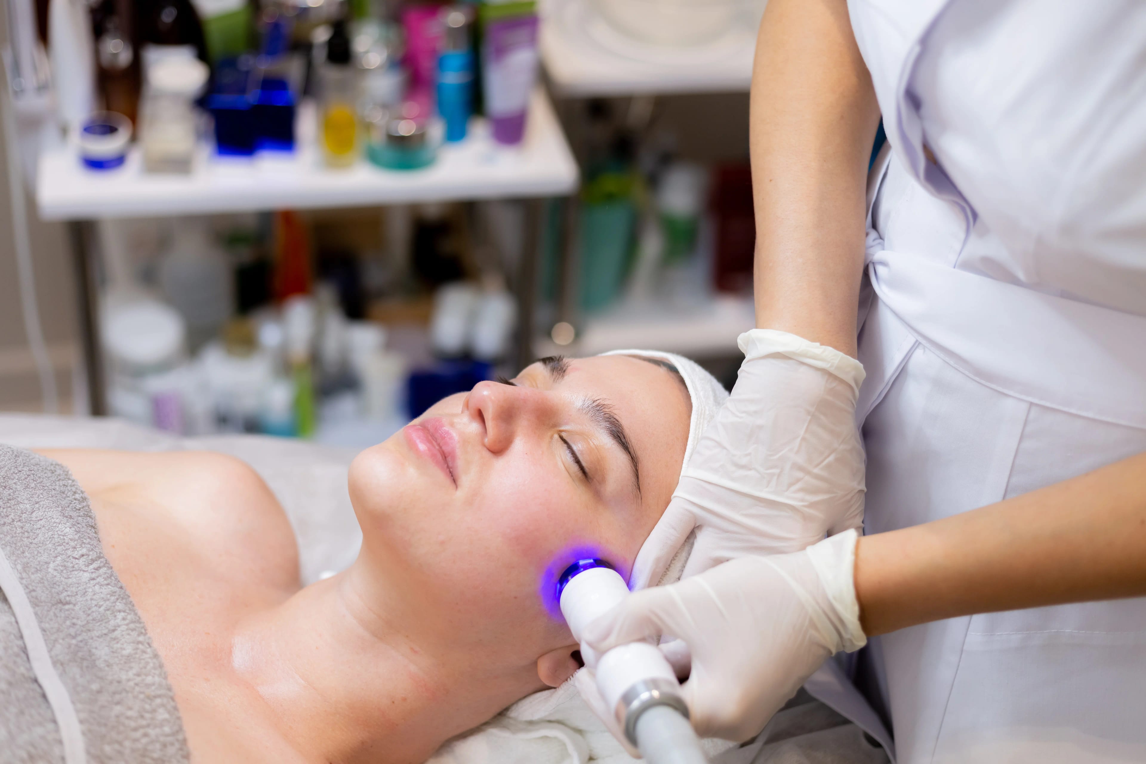 Skin laser treatment for pigmentation and acne scars in Karachi